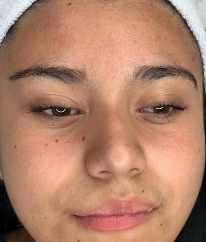Face Threading
